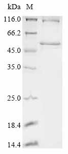 Human Ankyrin repeat and SOCS box protein 11 (ASB11) Recombinant Protein, Homo sapiens (Human), E.coli, N-terminal 6xHis-SUMO-tagged, 48.3 kDa, purity >≥ 85% as determined by SDS-PAGE.