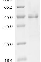 Mouse NACHT, LRR and PYD domains-containing protein 3 (Nlrp3), partial Recombinant Protein - BioCrest Sci