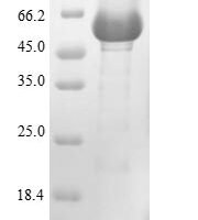 Human Lysosomal acid glucosylceramidase (GBA1) Recombinant Protein, N-10His - BioCrest Sci