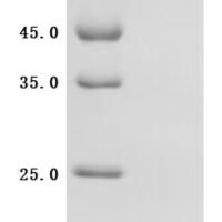 Human Atrial natriuretic peptide receptor 1 (NPR1), Partial Recombinant Protein - BioCrest Sci