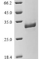 Marmota monax Tumor necrosis factor (TNF), partial Recombinant Protein, N-His-B2M - BioCrest Sci