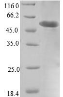 Mouse Properdin (Cfp) Recombinant Protein, N-His, aa 23–464, E.coli - BioCrest Sci