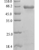 Human Beta-1,4-galactosyltransferase 3 (B4GALT3), partial Recombinant Protein - BioCrest Sci