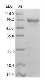 Human Beta-1,4-galactosyltransferase 3 (B4GALT3), partial Recombinant Protein, Homo sapiens (Human), E.coli, N-terminal GST-tagged, 67.2 kDa, purity >≥ 90% as determined by SDS-PAGE.