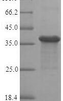 Human Ras-related protein Rab-8A (RAB8A), partial Recombinant Protein - BioCrest Sci