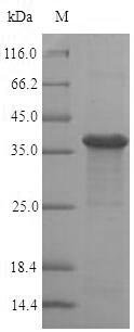 Human Ras-related protein Rab-8A (RAB8A), partial Recombinant Protein, Homo sapiens (Human), E.coli, N-terminal 6xHis-SUMO-tagged, 37.8 kDa, purity >≥ 90% as determined by SDS-PAGE.