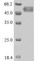 Human Antithrombin-III (SERPINC1) Recombinant Protein, N-His - BioCrest Sci