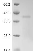 Mouse Calpain-3 (Capn3), partial Recombinant Protein, N-His, aa 46–419, Yeast - BioCrest Sci