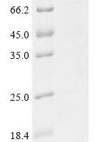 Human RNA cytosine C(5)-methyltransferase NSUN2 (NSUN2) Recombinant Protein - BioCrest Sci