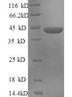 Human Serine/arginine-rich splicing factor 1 (SRSF1) Recombinant Protein - BioCrest Sci