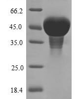 Pisum sativum Zinc finger CCCH domain-containing protein ZFN-like Recombinant Protein - BioCrest Sci