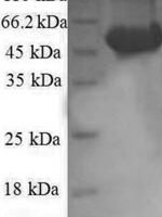 Human Ribosomal protein S6 kinase beta-2 (RPS6KB2), partial Recombinant Protein - BioCrest Sci