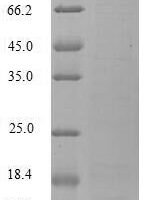 Vaejovis mexicanus smithi Potassium channel toxin alpha-KTx 21.1 Recombinant Protein - BioCrest Sci