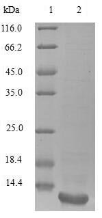 Vaejovis mexicanus smithi Potassium channel toxin alpha-KTx 21.1 Recombinant Protein, Vaejovis mexicanus smithi (Scorpion) (Vaejovis smithi), Mammalian cell, N-terminal 10xHis-tagged and C-terminal Myc-tagged, 7.9 kDa, purity >≥ 90% as determined by SDS-PAGE.