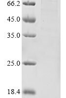 Human DNA polymerase theta (POLQ), partial Recombinant Protein, N-10His/C-Flag, aa 1–987 - BioCrest Sci