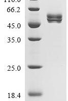 Rat Acyl-coenzyme A thioesterase 1 (Acot1) Recombinant Protein, C-10His - BioCrest Sci