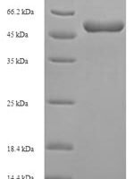 Mouse Abhydrolase domain-containing protein 11 (Abhd11) Recombinant Protein - BioCrest Sci