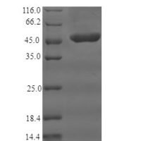 Human Complement receptor type 1 (CR1), partial Recombinant Protein - BioCrest Sci