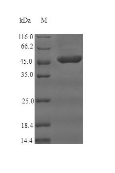 Human Complement receptor type 1 (CR1), partial Recombinant Protein, Homo sapiens (Human), E.coli, N-terminal GST-tagged, 48.4 kDa, purity >≥ 90% as determined by SDS-PAGE.