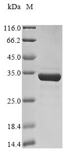 African swine fever virus Major capsid protein (Ba71V-081), partial Recombinant Protein, African swine fever virus (strain Badajoz 1971 Vero-adapted) (Ba71V) (ASFV), E.coli, N-terminal 10xHis-tagged and C-terminal Myc-tagged, 33.8 kDa, purity >≥ 85% as determined by SDS-PAGE.