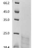 Human Tumor necrosis factor receptor superfamily member 13B (TNFRSF13B) Recombinant Protein - BioCrest Sci