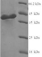 Human Complement C1q subcomponent subunit A (C1QA) Recombinant Protein, N-His-SUMO - BioCrest Sci