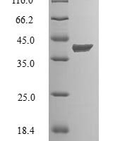 Human Cyclin-dependent kinase 2-interacting protein (CINP) Recombinant Protein - BioCrest Sci