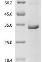 Humulus japonicus Humj1 Recombinant Protein, C-His, aa 1–155, E.coli - BioCrest Sci