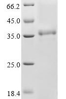 Bovine coronavirus Non-structural protein 2a (2a) Recombinant Protein, C-His, aa 1–278, strain LSU-94LSS-051, Baculovirus - BioCrest Sci