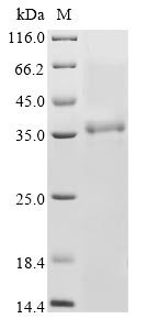Bovine coronavirus Non-structural protein 2a (2a) Recombinant Protein, C-His, aa 1–278, strain LSU-94LSS-051, Baculovirus, Bovine coronavirus (strain LSU-94LSS-051) (BCoV-LSU) (BCV), Baculovirus, C-terminal 6xHis-tagged, 37.6 kDa, purity >≥ 85% as determined by SDS-PAGE.