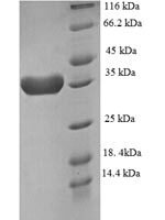 Human Eukaryotic translation initiation factor 4E-binding protein 2 (EIF4EBP2) Recombinant Protein, N-GST - BioCrest Sci