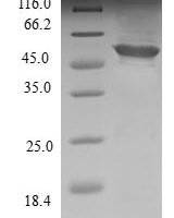 Human Probable methylthioribulose-1-phosphate dehydratase (APIP) Recombinant Protein, N-GST - BioCrest Sci
