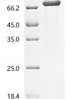 Mycobacterium tuberculosis NAD(P)H dehydrogenase (quinone) (lpdA) Recombinant Protein, N-GST - BioCrest Sci