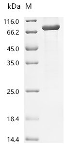 Mycobacterium tuberculosis NAD(P)H dehydrogenase (quinone) (lpdA) Recombinant Protein, N-GST, Mycobacterium tuberculosis (strain ATCC 25618 / H37Rv), E.coli, N-terminal GST-tagged, 77.0 kDa, purity >≥ 85% as determined by SDS-PAGE.