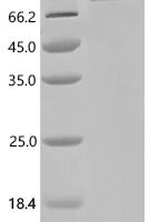 Human Polyadenylate-binding protein 1-like (PABPC1L) Recombinant Protein, N-10His/C-Myc - BioCrest Sci
