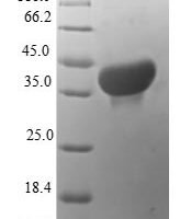 Human Protein S100-A14 (S100A14) Recombinant Protein, N-GST - BioCrest Sci