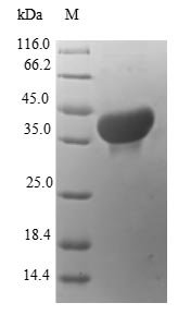 Human Protein S100-A14 (S100A14) Recombinant Protein, N-GST, Homo sapiens (Human), E.coli, N-terminal GST-tagged, 38.7 kDa, purity >≥ 90% as determined by SDS-PAGE.