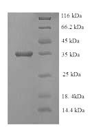Escherichia coli Ethanolamine ammonia-lyase light chain (eutC) Recombinant Protein - BioCrest Sci