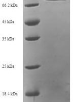 Human Target of rapamycin complex 2 subunit MAPKAP1 (MAPKAP1) Recombinant Protein, N-His-SUMO - BioCrest Sci