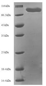 Human Target of rapamycin complex 2 subunit MAPKAP1 (MAPKAP1) Recombinant Protein, N-His-SUMO, Homo sapiens (Human), E.coli, N-terminal 6xHis-SUMO-tagged, 75.0 kDa, purity >≥ 90% as determined by SDS-PAGE.