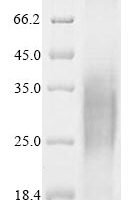 Macaca fascicularis Trophoblast glycoprotein (TPBG), partial Recombinant Protein - BioCrest Sci