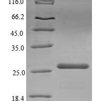 Spinacia oleracea Plastocyanin,chloroplastic (PETE), partial Recombinant Protein - BioCrest Sci