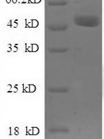 Human Ubiquitin thioesterase OTUB1 (OTUB1), partial Recombinant Protein - BioCrest Sci