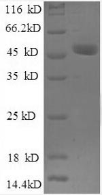 Human Ubiquitin thioesterase OTUB1 (OTUB1), partial Recombinant Protein, Homo sapiens (Human), E.coli, N-terminal GST-tagged, 50.1 kDa, purity >≥ 90% as determined by SDS-PAGE.