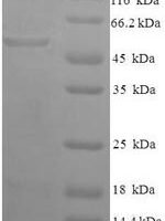 Human Glycerol-3-phosphate dehydrogenase [NAD (+)], Cytoplasmic domain (GPD1) Recombinant Protein - BioCrest Sci