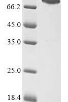 Human Eukaryotic peptide chain release factor GTP-binding subunit ERF3A (GSPT1) Recombinant Protein, N-MBP/C-His - BioCrest Sci