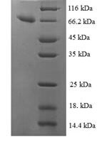 Human Isocitrate dehydrogenase [NAD] subunit beta, mitochondrial (IDH3B) Recombinant Protein - BioCrest Sci