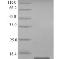 Mouse Single Ig IL-1-related receptor (Sigirr) Recombinant Protein - BioCrest Sci
