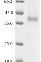 Sheep Dipeptidase 1 (DPEP1) Recombinant Protein - BioCrest Sci