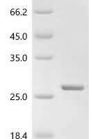 Human Galectin-9 (LGALS9), partial Recombinant Protein, C-His - BioCrest Sci